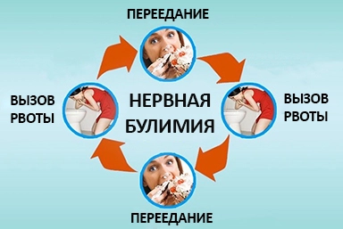 Лечение булимии в Катайске